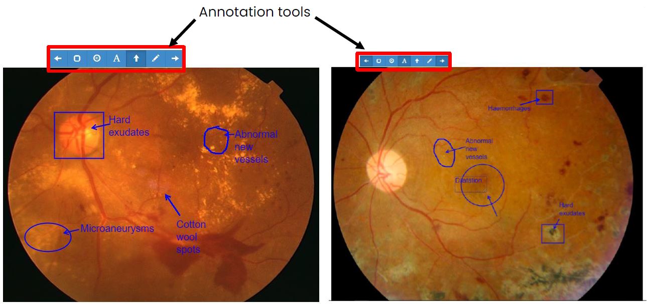 DRCS Annotation Tools